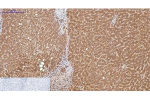 Immunohistochemistry of paraffin-embedded Human liver tissue using COL3A1 Monoclonal Antibody at dilution of 1:200.