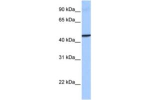 Western Blotting (WB) image for anti-Guanylate Binding Protein 4 (GBP4) antibody (ABIN2463521) (GBP4 anticorps)