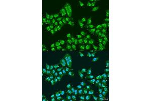 Immunofluorescence analysis of U2OS cells using THOC1 antibody. (THOC1 anticorps  (AA 428-657))