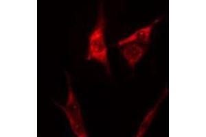 ABIN6275263 staining 293 cells by IF/ICC. (Myosin anticorps  (Internal Region))