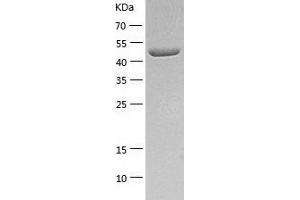 Western Blotting (WB) image for Carboxypeptidase E (CPE) (AA 43-476) protein (His-IF2DI Tag) (ABIN7122142)