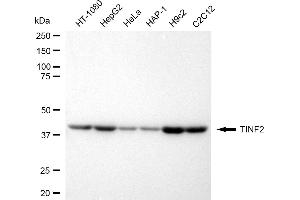 Western blotting analysis using TINF2 antibody (ABIN7800532).