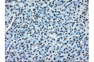 Image no. 15 for anti-B-Raf proto-oncogene, serine/threonine kinase (BRAF) antibody (ABIN1496961)