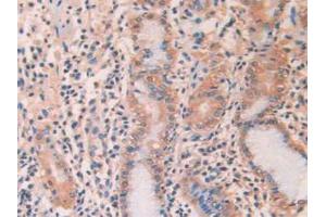 IHC-P analysis of Human Stomach Tissue, with DAB staining. (SERPINA1 anticorps  (AA 25-418))