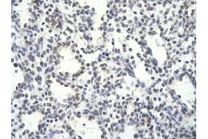 Rabbit Anti-PSMD14 antibody        Paraffin Embedded Tissue:  Human Lung cell   Cellular Data:  Epithelial cells of renal tubule  Antibody Concentration:   4.