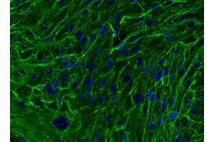 Immunofluorescent analysis of Fibronectin in mesenchymal stem cells (MSC).