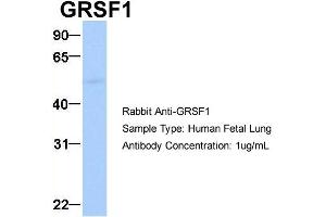 Host:  Rabbit  Target Name:  GRSF1  Sample Type:  Human Fetal Lung  Antibody Dilution:  1. (GRSF1 anticorps  (Middle Region))