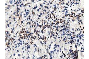 Immunohistochemical staining of paraffin-embedded Human prostate tissue using anti-MICAL1 mouse monoclonal antibody. (MICAL1 anticorps)