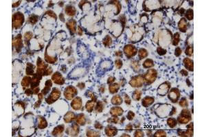 Immunoperoxidase of monoclonal antibody to TCN1 on formalin-fixed paraffin-embedded human salivary gland.