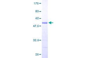Image no. 1 for Proteasome (Prosome, Macropain) Subunit, beta Type, 9 (Large Multifunctional Peptidase 2) (PSMB9) (AA 1-219) protein (GST tag) (ABIN1316597)