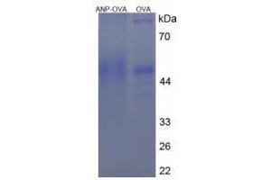 Image no. 1 for Natriuretic Peptide A (NPPA) peptide (Ovalbumin) (ABIN5666089) (Natriuretic Peptide A (NPPA) peptide (Ovalbumin))