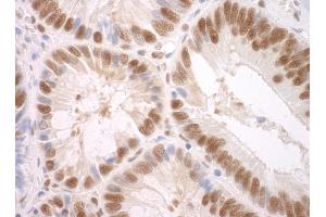 Immunohistochemistry (IHC) image for anti-Splicing Factor 3a, Subunit 3, 60kDa (SF3A3) (AA 451-501) antibody (ABIN7448790)