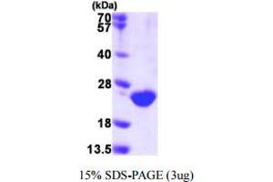SDS-PAGE (SDS) image for Dual Specificity Phosphatase 3 (DUSP3) (AA 1-185) protein (His tag) (ABIN667577)