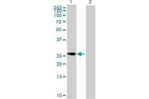 Western Blot analysis of SFRS9 expression in transfected 293T cell line by SFRS9 MaxPab polyclonal antibody. (SFRS9 anticorps  (AA 1-221))