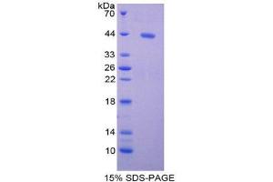 SDS-PAGE (SDS) image for Brain-Derived Neurotrophic Factor (BDNF) (AA 147-249) protein (His tag,GST tag) (ABIN2122501)