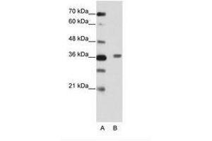 Image no. 2 for anti-BTB (POZ) Domain Containing 6 (BTBD6) (AA 87-136) antibody (ABIN202456) (BTBD6 anticorps  (AA 87-136))
