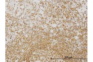 Image no. 1 for anti-N-Methylpurine-DNA Glycosylase (MPG) (AA 1-90) antibody (ABIN598818) (MPG anticorps  (AA 1-90))