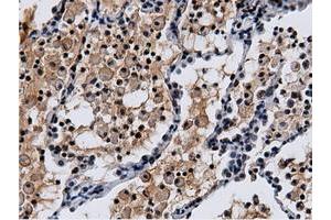 Immunohistochemistry (IHC) image for anti-5'-Nucleotidase Domain Containing 1 (NT5DC1) antibody (ABIN1499836)
