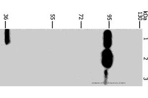 Western blot analysis of Mouse stomach tissue, 293T and Jurkat cell, using PLA2G4B Polyclonal Antibody at dilution of 1:1400 (PLA2G4B anticorps)