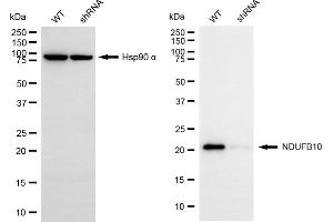 Western blotting analysis using NDUFB10 antibody (ABIN7799547).