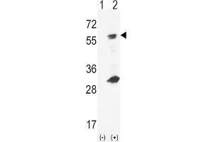 Western Blotting (WB) image for anti-Glucokinase (Hexokinase 4) (GCK) antibody (ABIN5023820) (GCK anticorps)