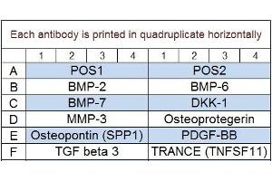 Image no. 1 for Human Bone Metabolism Array Q2 (ABIN4956025) (Humain Bone Metabolism Array Q2)
