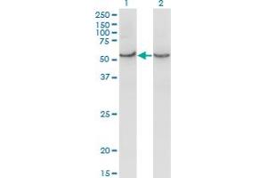 Western Blot analysis of COX15 expression in transfected 293T cell line by COX15 monoclonal antibody (M01), clone 2D2. (COX15 anticorps  (AA 92-152))