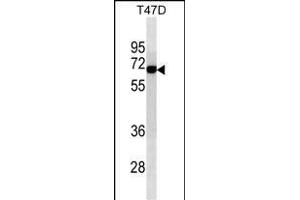 ALB Antibody (ABIN1539925 and ABIN2843868) western blot analysis in T47D cell line lysates (35 μg/lane). (Albumin anticorps  (AA 540-569))