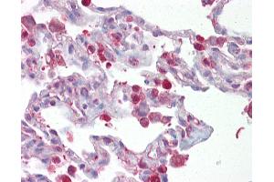 Anti-FOSL1 / FRA1 antibody IHC of human lung. (FOSL1 anticorps  (AA 143-192))