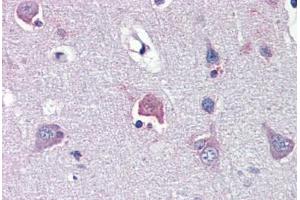 anti-Leucine Zipper, Down-Regulated in Cancer 1 (LDOC1) (N-Term) antibody