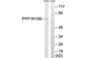 Western blot analysis of extracts from mouse brain cells, using PPP1R16B Antibody. (PPP1R16B anticorps  (AA 364-413))
