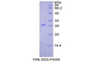 SDS-PAGE analysis of Cow UCHL5 Protein.