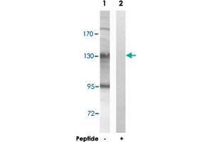 Western blot analysis of extracts from HUVEC cells, using AZI1 polyclonal antibody . (AZI1 anticorps)