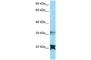 WB Suggested Anti-NDUFA8 AntibodyTitration: 1.