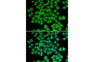 Immunofluorescence analysis of HeLa cells using ATF2 antibody.
