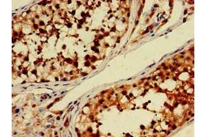 Immunohistochemistry of paraffin-embedded human testis tissue using ABIN7150681 at dilution of 1:100 (PDE11A anticorps  (AA 42-190))