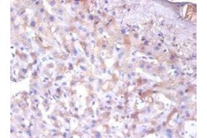 Immunohistochemistry of paraffin-embedded human liver tissue using ABIN7151681 at dilution of 1:100 (ERP29 anticorps  (AA 40-251))