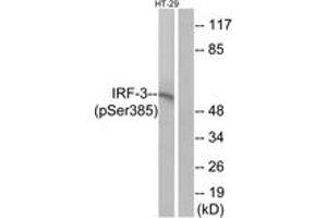 Western blot analysis of extracts from HT29 cells treated with INSULIN 0. (IRF3 anticorps  (pSer385))