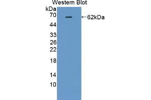 Western blot analysis of recombinant Human IK.
