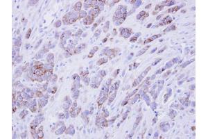 IHC-P Image Immunohistochemical analysis of paraffin-embedded MDAMB468 xenograft , using phospholipid scramblase 1, antibody at 1:500 dilution.