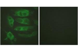 Immunofluorescence (IF) image for anti-Adrenergic, beta-2-, Receptor, Surface (ADRB2) (AA 321-370) antibody (ABIN2888906) (beta 2 Adrenergic Receptor anticorps  (AA 321-370))