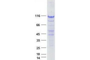 Validation with Western Blot
