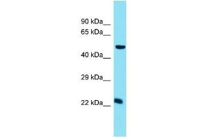 Host: Rabbit  Target Name: Chmp5  Sample Tissue: Mouse Small Intestine lysates  Antibody Dilution: 1. (CHMP5 anticorps  (C-Term))