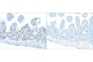 Immunohistochemistry (IHC) image for anti-Replication Protein A2, 32kDa (RPA2) (pSer4), (pSer8) antibody (ABIN7455212) (RPA2 anticorps  (pSer4, pSer8))
