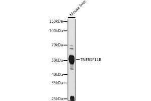 Western blot analysis of extracts of Mouse liver, using TNFRSF11B antibody (ABIN3022914, ABIN3022915, ABIN3022916 and ABIN6219293) at 1:1000 dilution.