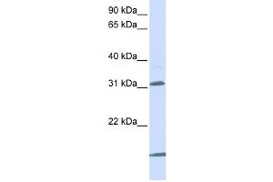 Western Blotting (WB) image for anti-Solute Carrier Family 25 (Mitochondrial Carrier, Oxoglutarate Carrier), Member 11 (SLC25A11) antibody (ABIN2458782) (SLC25A11 anticorps)