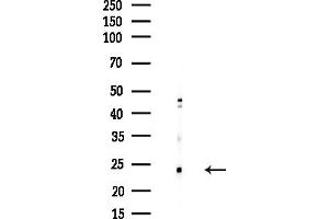 Western blot analysis of lysates from HUVEC cells(starvation,24h treatment), using RPL28 Antibody at 1/1000 dilution.