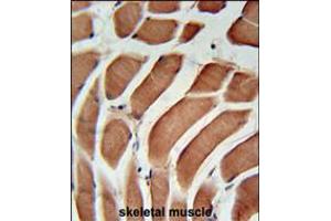 SIKE Antibody immunohistochemistry analysis in formalin fixed and paraffin embedded human skeletal muscle followed by peroxidase conjugation of the secondary antibody and DAB staining. (SIKE1 anticorps  (C-Term))