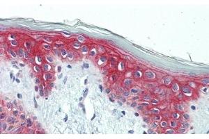 Detection of DSP in Human Skin Tissue using Polyclonal Antibody to Desmoplakin (DSP)