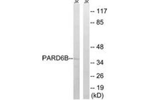 Western blot analysis of extracts from Jurkat cells, using PARD6B Antibody. (PARD6B anticorps  (AA 233-282))